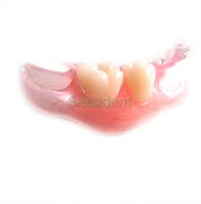 Bei der versorgung eines zahnlosen kiefers durch eine implantatgetragene prothese in den vom. Prothese Materialien Flexible Prothese Material Valplast Material Buy Acryl Denture Materialien Dental Flexible Materialien Flexible Prothese Product On Alibaba Com