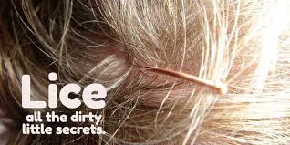 Image result for lice vs dandruff