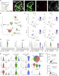 The most common type of pancreatic cancer, called ductal adenocarcinoma, begins in the cells lining the pancreatic ducts. Type I Collagen Deletion In Asma Myofibroblasts Augments Immune Suppression And Accelerates Progression Of Pancreatic Cancer Sciencedirect