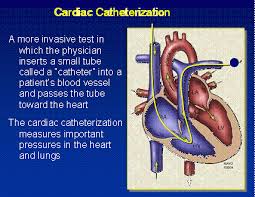 Pulmonary Hypertension In Scleroderma Michigan Medicine