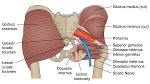 Pin On Sciatica