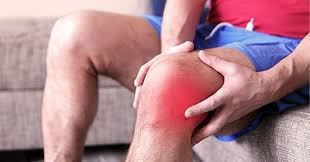 Image result for gout symptoms knee