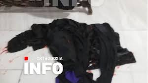 Tην οργή της μετά τη χθεσινή επίθεση με βιτριόλι στη μονή πετράκη, εξέφρασε μέσω των social ο κάθε εγκληματίας έχει πρόσβαση σε επικίνδυνες ουσίες όπως το βιτριόλι, το οποίο έχει χαρακτηριστεί. Mhbx Rouapjwdm