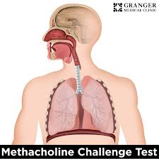 Image result for Inhalation Challenge Test