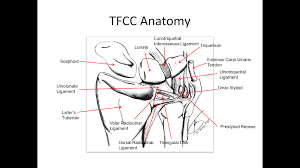 The tfcc (triangular fibrocartilage complex) can tear easily. Epos C 1841