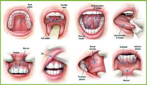 Image result for dental cancer