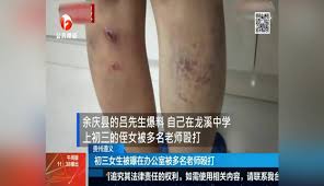 蓝色的思念流转】初三女生被曝在办公室被多名老师殴打-1万粉丝8千作品期待你的评论_资讯视频-免费在线观看-爱奇艺