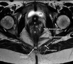 The superior tissue contrast and flexible imaging planes afforded by magnetic resonance imaging (mri) versus competing technologies permit optimal targeted protocols developed for specific pelvic visceral organs highlight important anatomic features that may not be imaged by other modalities. Multimodality Imaging Of Pelvic Floor Anatomy Springerlink