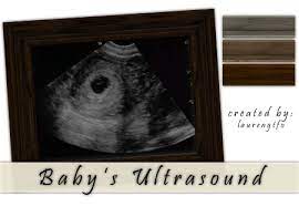 The sims 4 ultrasound mod. Xolaurengtfo S Baby S Ultrasound