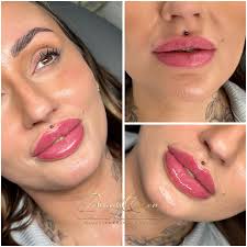 My beautiful doll ❤️🥹🌸💋💉 @beautybaebyewelina ❤️ #lipsfillers💋  #dermalfillers #aesththic