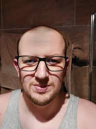 UPDATE: Bit the bullet and feel loads better for it : r/bald