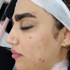 🌿elham.azizi🌿الهام عزیزی‎