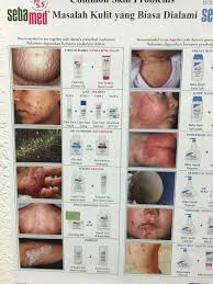 Lawatan klinik pakar kulit ini bertujuan untuk memberi rawatan kepada para pesakit yang menghidapi penyakit kulit yang kronik atau yang perlu rawatan berterusan yang mempunyai kesulitan untuk datang ke hospital pulau pinang. Klinik Mohd Harun Home Facebook