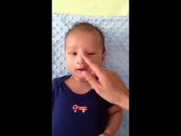 Crigler Massage For Clogged Tear Duct Blocked Tear Duct Baby Clogged Tear Duct Baby Baby Girl Fall Outfits