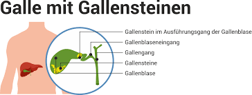 Gallenbeschwerden Symptome Ernahrung Behandlung Wolfs Apotheke Bredstedt