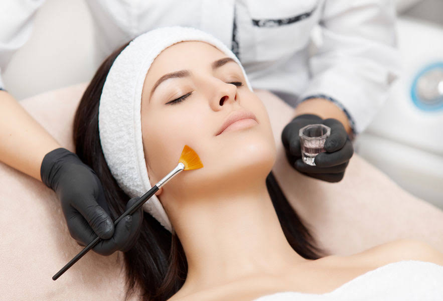 Chemical Peels product image