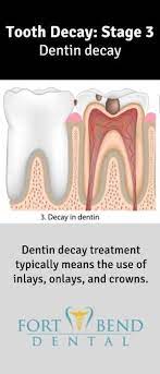 Pin On Oral Health