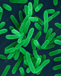 Image result for yersinia fotos