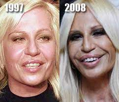 donatello versace plastic surgery celebrity plastic surgery bad plastic surgeries