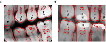 An Effective Classification And Numbering System For Dental