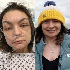 O'n i'n ofnadwy o lwcus i gael trawsblaniad mewn pryd' ❤️ Dyma stori Lois  Owens o Bwllheli 👉 https://bbc.in/3LktTYs