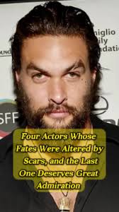 Michael Hollick Scar