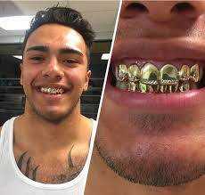 Download and install gold teeth photo editor 3.0 on windows pc. Dientes De Oro For Android Apk Download