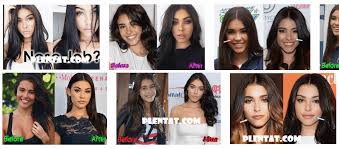 Madison Beer Plastic Surgery Before And After American Singer