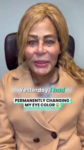 Surgery changed the color of my eyes 😱