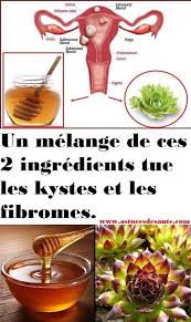 A Mixture Of These Two Ingredients Kills Cysts And Fibroids Cysts Fibroids Ingredients Kills Mixture Fibroids Health Tips Homemade Remedies