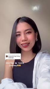 Fabi Teeth Before and After