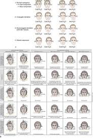 Image result for Oculovestibular Testing