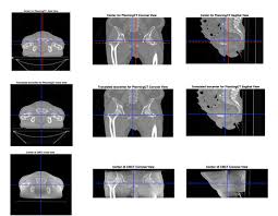 Maybe you would like to learn more about one of these? Pelvic Reference Data The Cancer Imaging Archive Tcia Public Access Cancer Imaging Archive Wiki