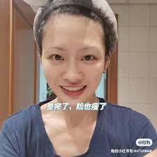 逛了迪拜至少五家牙医，龅牙整好了- HUIYI WANG