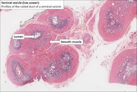 Image result for Seminal Vesicle