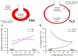 Image result for Diffusing Capacity
