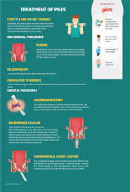 They most frequently strike when. Piles Treatment Surgery Causes Symptoms Apollo Spectra