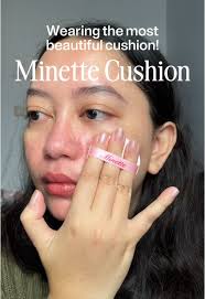 Luminette Honest Review