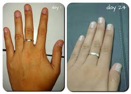 Pin By Ayu Dewi On Make Up Nails Daily Nail Nails Nail Bitting