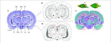 It is a tropical world filled with an endless archipelago, dotted with ruins made of marbled cheese. Mapping A Coronal Rat Brain Section With A Slight Tilt To A Reference Download Scientific Diagram