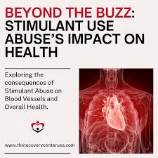 Image result for Stimulant Use Disorder