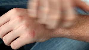 We heard further scratchings at the door as the dog whined to be let in. When Scratching Becomes More Than A Nervous Habit Uchicago Medicine