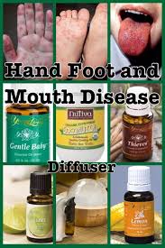 Hand Foot And Mouth Disease Https Www Youngliving Com Signup Sponsorid 1496528 Enrollerid 149 Hand Foot And Mouth Essential Oils Herbs Essential Oil Recipes