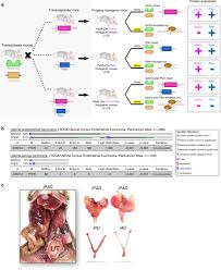 Endometrial cancer is a cancer that starts in the lining of the uterus called the endometrium. Inactivation Of Arid1a In The Endometrium Is Associated With Endometrioid Tumorigenesis Through Transcriptional Reprogramming Nature Communications