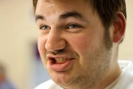 Mark Otto, Superstar