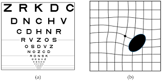 vision free full text recent advances of computerized