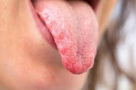 وانا مفارقه فلقتي طيزي بيدي كان يقولي افتحي طيزك اكثر حبيبتي ابي استمتع بأكبر قدر من طيزك ابي أوصل لساني لأعماق طيزك آآآآآآه ما أشهى طيزك ياساره وكنت أحاول أفتح. Ø¹Ù„Ø§Ù…Ø© ÙÙŠ Ø§Ù„Ù„Ø³Ø§Ù† ØªØ¯Ù„ Ø¹Ù„Ù‰ Ø¥ØµØ§Ø¨ØªÙƒ Ø¨Ù…Ø±Ø¶ Ù…Ø²Ù…Ù† Ø§Ù„ÙˆÙƒÙŠÙ„ Ø§Ù„Ø§Ø®Ø¨Ø§Ø±ÙŠ