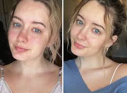 Skin-tastic Success: 39 Reviewed and Rated Skincare Products That Actually  Work