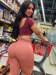 Woman reveals she was bullied for the appearance of her legs | news.com.au  — Australias leading news site