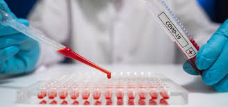 Así, las letras griegas son la denominación de las variantes de coronavirus detectadas hasta el presente. Coronavirus La Variante Delta Del Sars Cov 2 Mas Contagiosa Que La Alfa